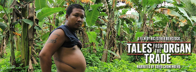 Hot Docs 2013: ‘Tales from the Organ Trade’ Review